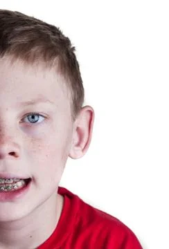 Boy with braces Foto stock