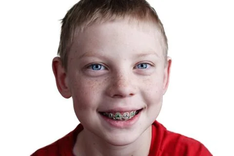 Boy with braces Foto stock