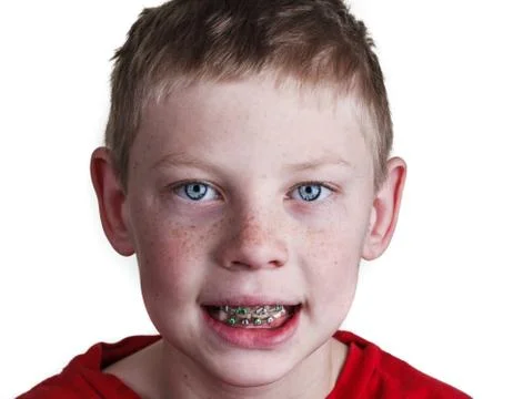 Boy with braces Foto stock