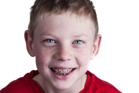 Boy with braces Foto stock