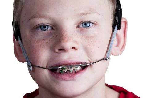 Boy with braces Foto stock