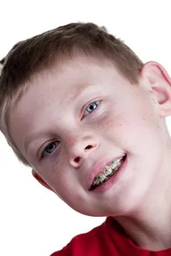 Boy with braces Foto stock