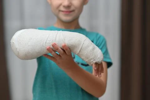 A boy with a broken arm in a cast. close-up. Stock Photos