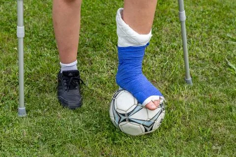 Boy with a broken leg in a cast during a football match an injury to a youn.. Stock Photos