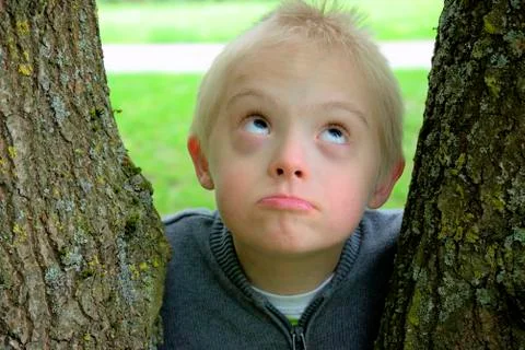 Boy with down syndrome looking up to the sky and hugged to a tree. Stock Photos