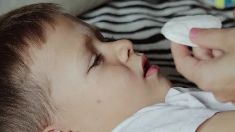 The boy fell ill with conjunctivitis, his mother instills a medicinal solution Stock Footage 119277953