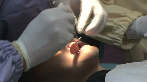 Boy Getting His Teeth Checked At The Dentist 스톡 동영상 32376668