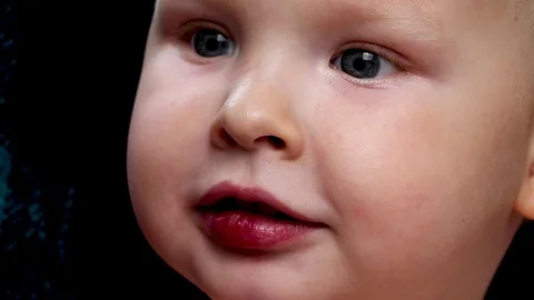 The boy has a broken wound on the lips Stock Footage 90352256