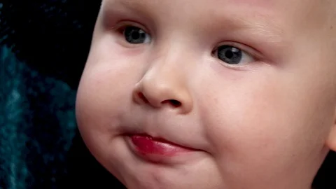 The boy has a broken wound on the lips Stock Footage 90352278