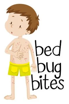 Boy having bed bug bites Stock Illustration