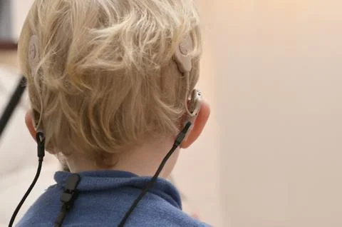 Boy With A Hearing Aids And Cochlear Implants Stock Photos