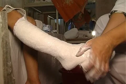 Boy impose gypsum Stock Footage 12351607