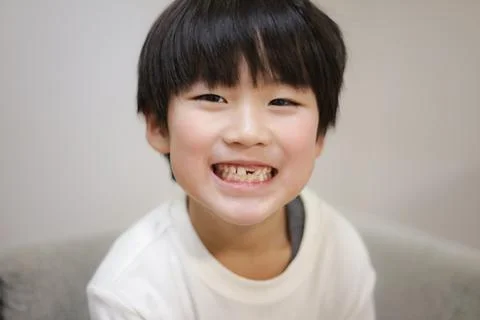 A boy with missing front teeth Stock Photos
