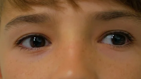 The boy moves his eyes in different directions Stock Footage 83632438