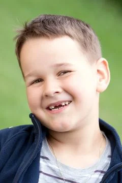 Boy outdoors without upper two teeth with smile Stock Photos