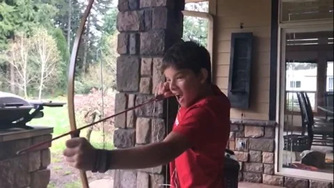 Boy pulls his tooth out with a bow and arrow 動画素材 109256301