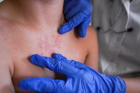 A boy with a red rash is being checked by the physician. Stock Photos