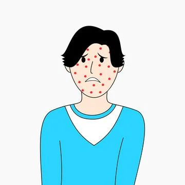 A boy with red spots on his face Stock Illustration