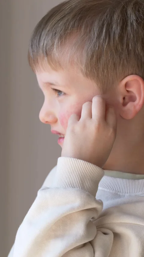 Boy scratching cheek in profile shows rash and irritation. Itch symptom Stock Footage 330973621