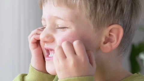 Boy scratching red cheek, visible rash showing allergy, atopic dermatitis Stock Footage 330973195