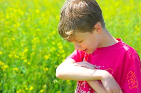 Boy on the spring field bitten by insect Stock-Fotos