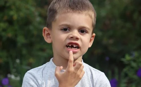 A boy without a tooth. Selective focus. Foto stock