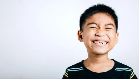 Boy without upper tooth smiles wide showing the gap. Child isolated portrait on Stock Photos