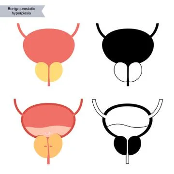 BPH info concept Stock Illustration