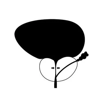 BPH info concept Stock Illustration