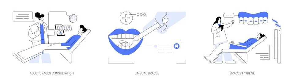 Braces for adults abstract concept vector illustrations. 库存插图