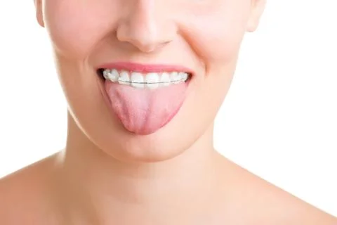 Braces Stock Photos