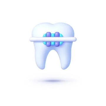 Braces tooth 3d, great design for any purposes. Orthodontic dentistry. Isolated Stock Illustration