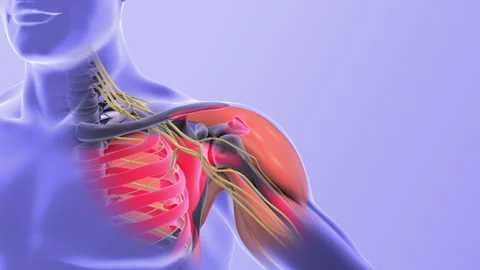 Brachial Plexus Nerve Route from Neck to Hand Stock Footage 296104189