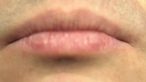 BRACKET SYSTEM teeth Video stock 98656721