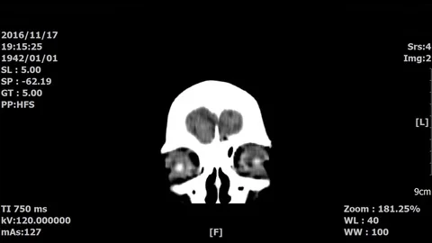 Brain-02 Stock Footage 98329742