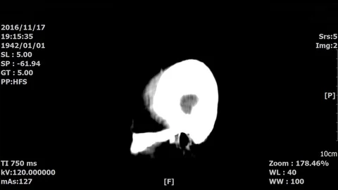 Brain-03 Stock Footage 98329726