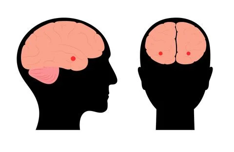 Brain amygdala anatomy Stock Illustration