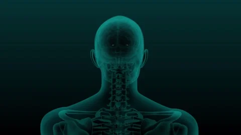 Brain Amygdala Xray Stock Footage 252884214