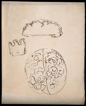 A brain; and two sections of brain (?). Drawing. Stock Illustration