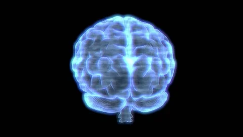 Brain bad reception 库存影片 157757551