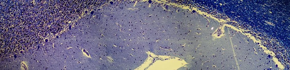 Brain cells under the microscope 100x Stock Photos