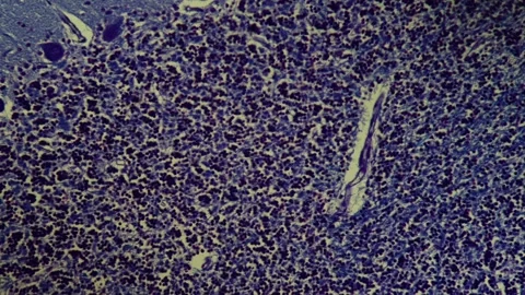 Brain cerebrum tissue under the microscope Stock Footage 343126795