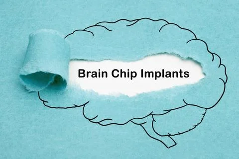 Brain Chip Implants Technology Concept Stockfoto's
