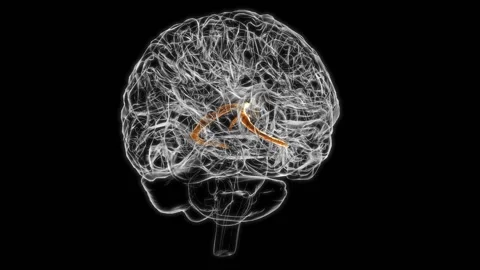 Brain Choroid Plexus Of Cerebral Hemisph... | Stock Video | Pond5