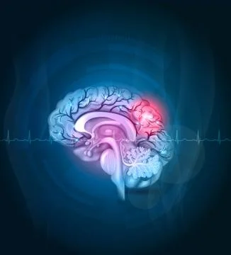 Brain cross section, arteries Stock Illustration