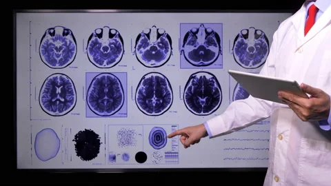 Brain Ct Presentation  Stock-Footage 202146367
