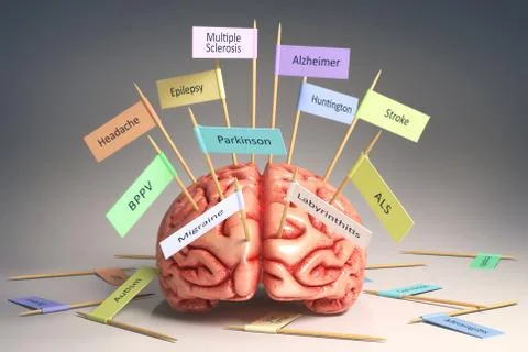 Brain Diseases 스톡 일러스트