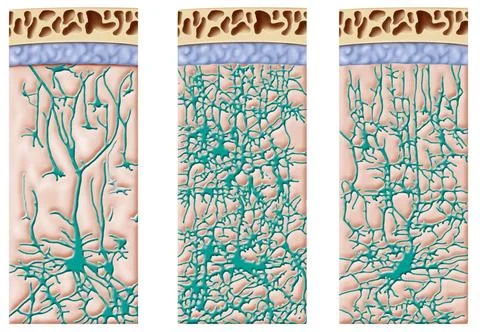  Brain, drawing Development of a child s brain cell network. Illustration ... Foto stock