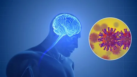 Brain Encephalitis Caused by Nipah Virus Stock Illustration