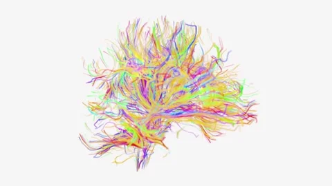 Brain Fibers formation video | Brain Fibers Creative visualization Stock Footage 334351885
